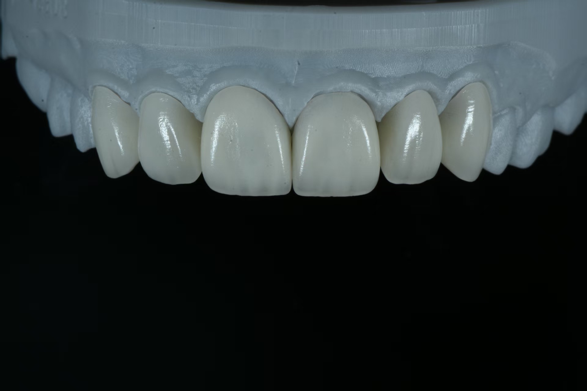 Orthodontics