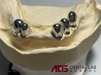 Smile Design